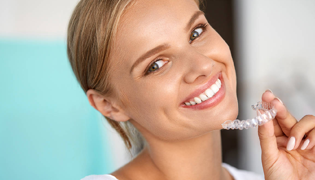 Braces and Aligners